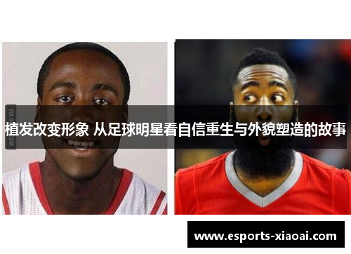 植发改变形象 从足球明星看自信重生与外貌塑造的故事